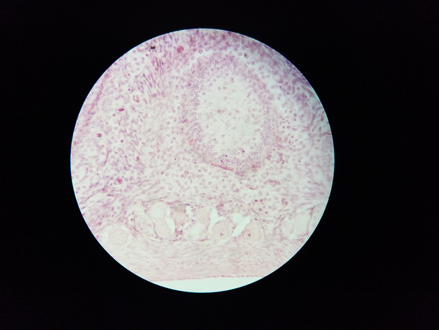 Ovary Slides - Ovary 010 400X